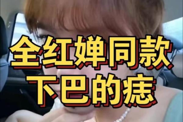 痣相失职如何影响命运与健康的潜在风险