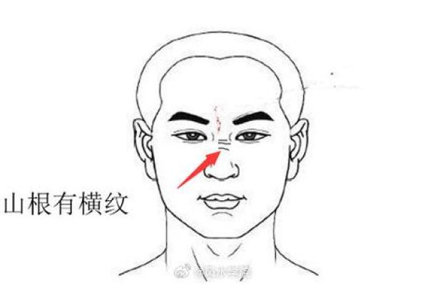 如何通过面相学改善山根低的面部特征