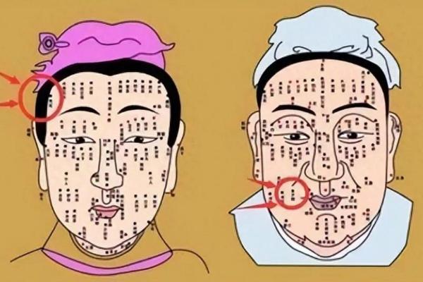 痣相的起源与发展：古代文化中的神秘象征
