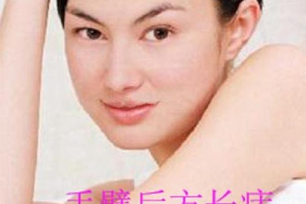胳膊痣相解读：如何通过痣的位置判断性格