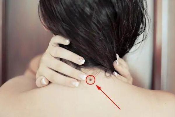 女性背部痣相分析：如何通过背部痣识别人生趋势