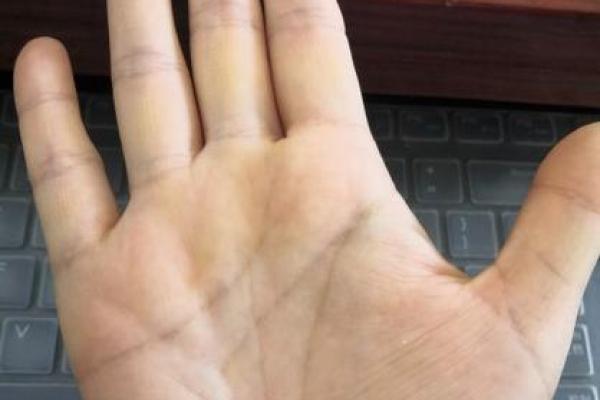 所罗门环手相是否真能预示命运的变化