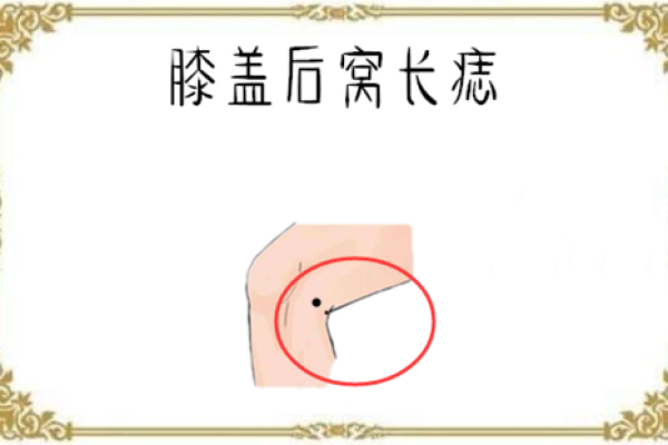 探索大腿内侧痣相对人生运势的影响