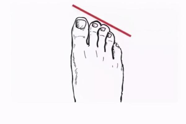 脚步与命运：如何从脚的形状看你的未来运势