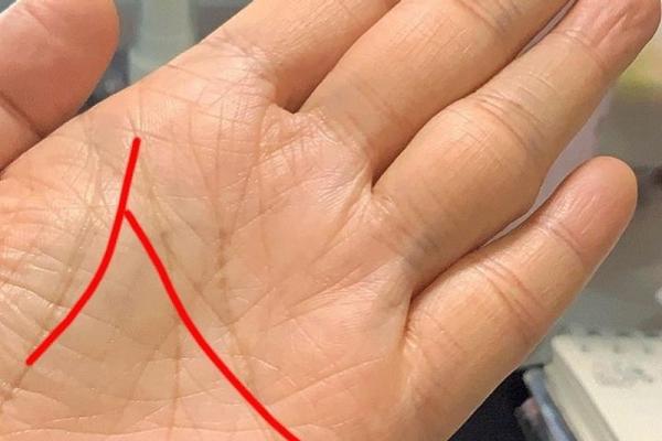 深度解析假性断掌手相的性格与运势