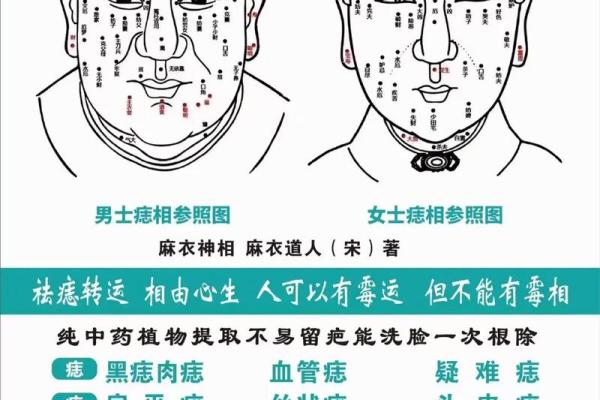 痣相学入门：通过面部痣相识别性格特征