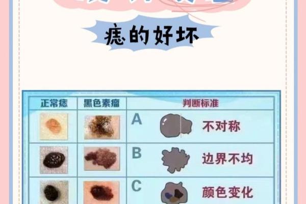 从痣的位置解读个人命运：痣相好坏一目了然