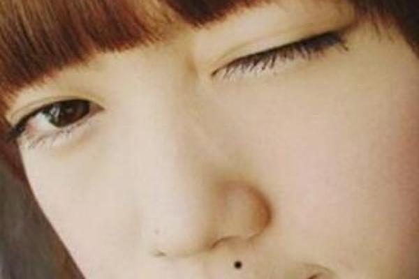 臀部痣的面相意义与人生轨迹关系