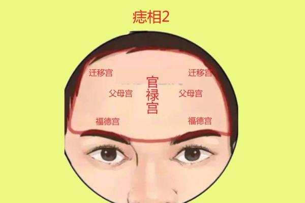 痣相与健康：不同部位痣的象征意义