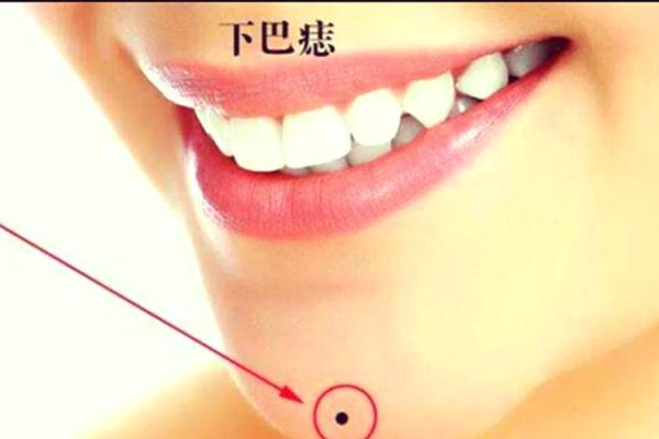 痣相分析：女人身上的痣揭示的命运秘密