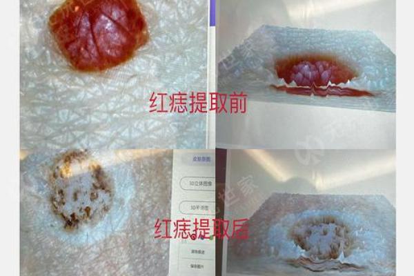 全方位解读痣相与身体各部位的联系