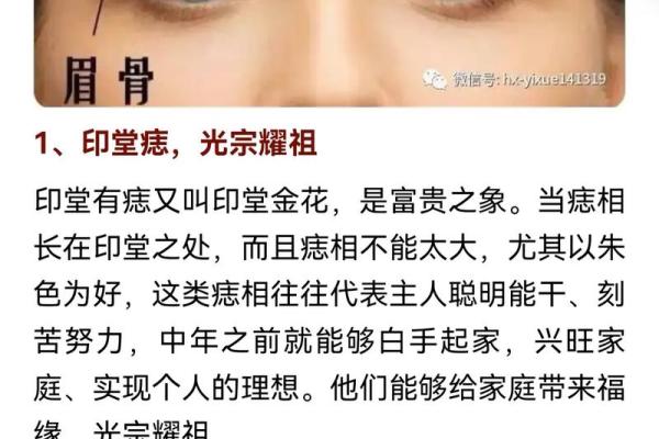 痣相不宜出是什么意思及其在面相学中的影响分析