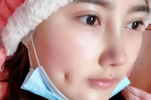 男人有酒窝面相的象征意义与性格分析