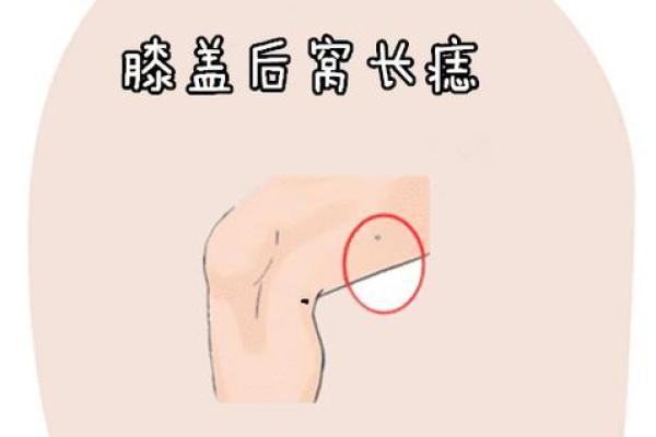 膝盖痣相的象征意义与性格解析