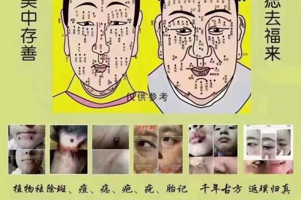 痣相解读：女性面部痣的位置与命运解析
