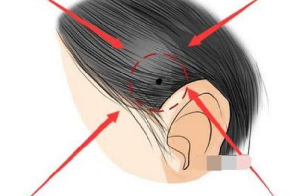 大腿内侧痣相的传统解读与现代观念