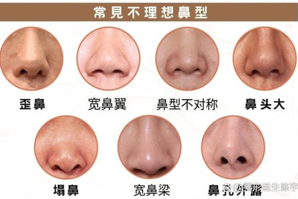 歪鼻面相解析：如何从鼻型看出你的性格与命运