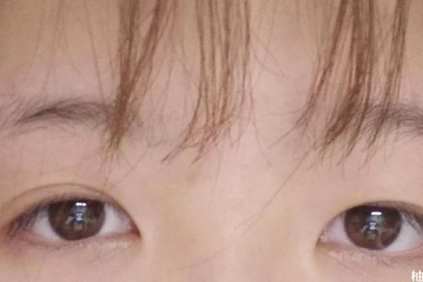 探索阴阳眼面相特征与命运变化