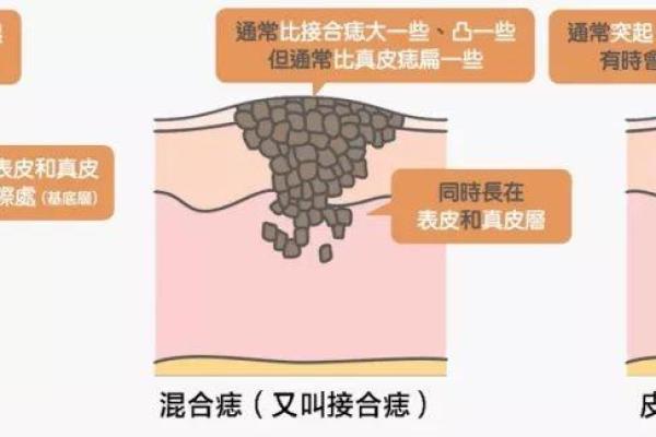 色难之相与眼角痣的关系：命运与性格的隐秘联系