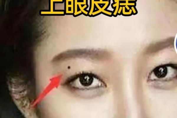 从眼周痣看你的运势与性格特征