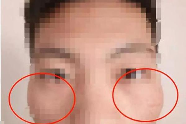 眉间距窄的男人面相透露出的内心世界与情感特征