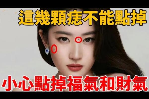 面部痣相真的能决定运势吗？专家为你揭秘