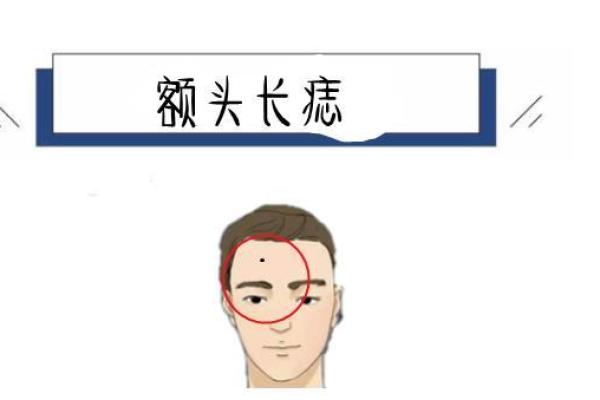 后背长痣象征贵人相助的深层含义