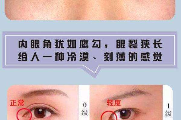 眼角下垂面相的含义与调理方法解析