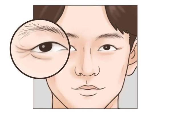 眼角下垂面相解读：影响运势与健康的隐秘信号