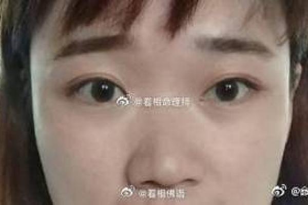 探讨鼻子山根低对命运的潜在影响