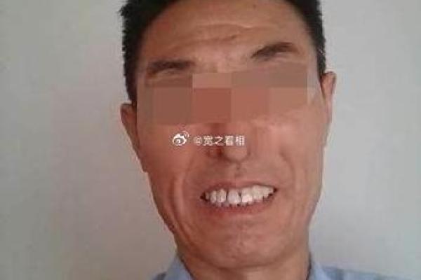 男士抬头纹面相解析：揭示性格与运势的奥秘