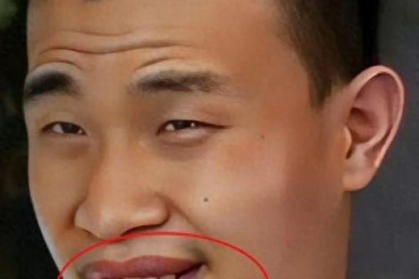年轻掉牙面相之谜