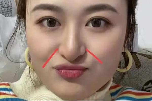 面相揭秘：断鼻女人命运多舛，运势起伏之谜