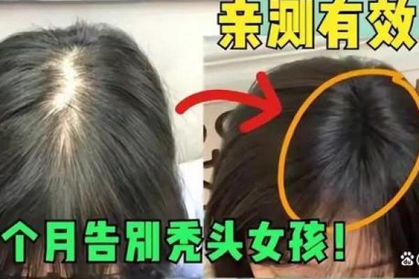 脱发危机？揭秘面相学中头发稀少的秘密！