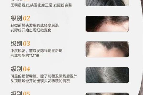脱发危机？揭秘面相学中头发稀少的秘密！