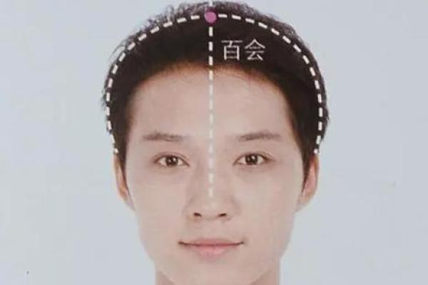 疾病印记：面相解码健康秘密