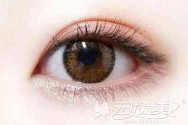 眼角微扬，命运之窗洞开