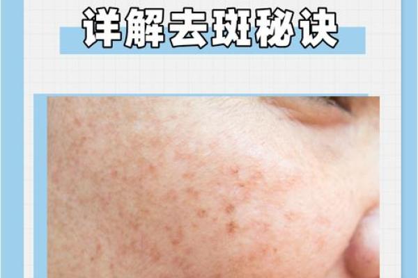 面相解析：雀斑鼻梁的奥秘与寓意