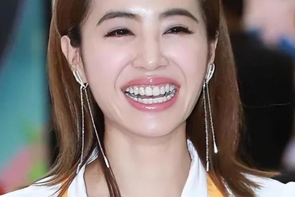 小嘴美女，颜值爆表！