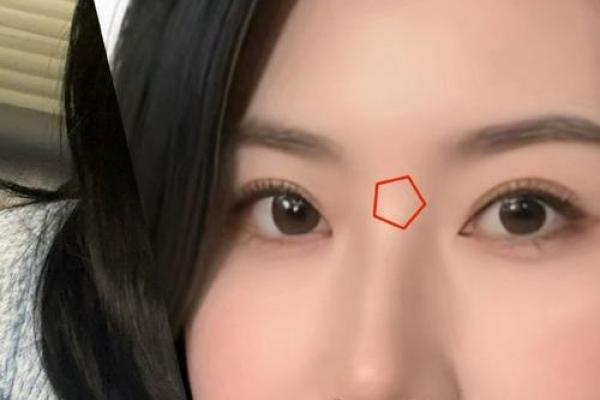 鼻根高陷面相之谜