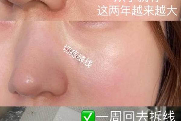 男人生来有痣，财运亨通的痣相揭秘！