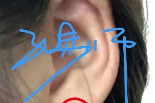 耳朵上的小秘密：女人耳相痣的神秘力量！