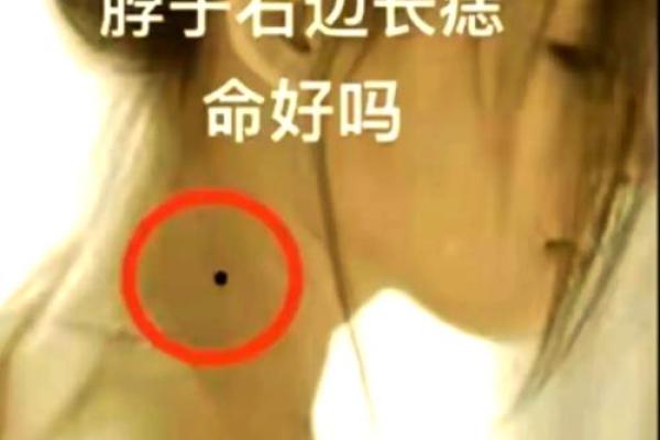 痣相揭秘：女人痣相大全图解，命运密码一网打尽！