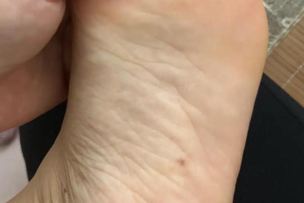 脚底痣相大全：看痣识命运，揭秘你的运势走向！