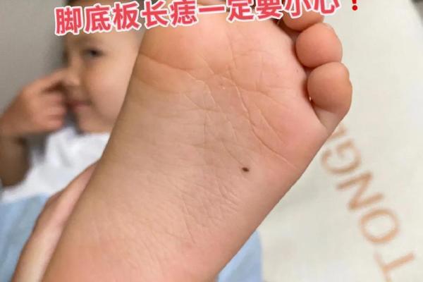 脚底痣相大全：看痣识命运，揭秘你的运势走向！