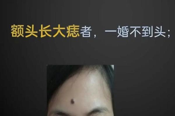 嘴边痣的秘密：美丽与命运的交织