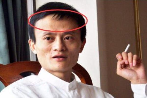额头疤痕面相解析：命运转折的神秘印记