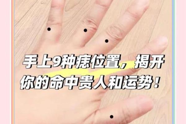 小拇指痣相揭秘：你的命运密码在这里！