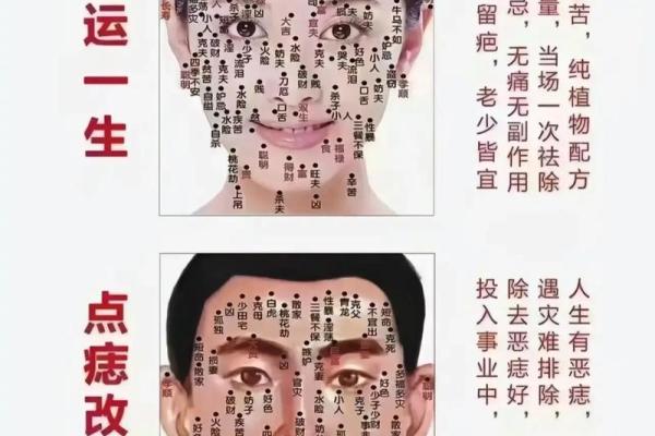 痣相解析：耳朵上的二婚痣预示着什么？
