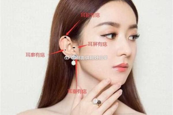 痣相解析：耳朵上的二婚痣预示着什么？